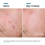 SkinCeuticals Advanced RGN-6 Восстанавливающий и регенерирующий крем 50 мл — изображение 4